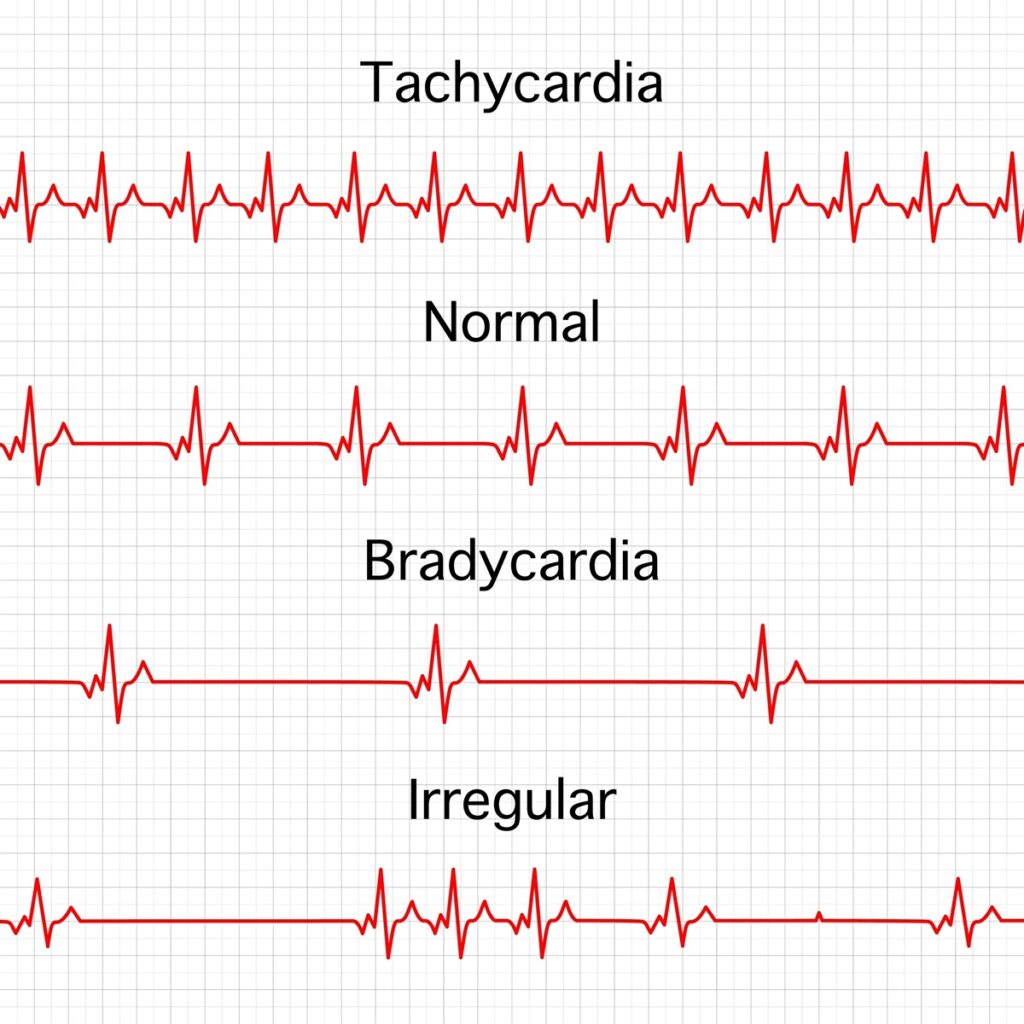 Heart Rhythm Week 2024 | LFA First Response